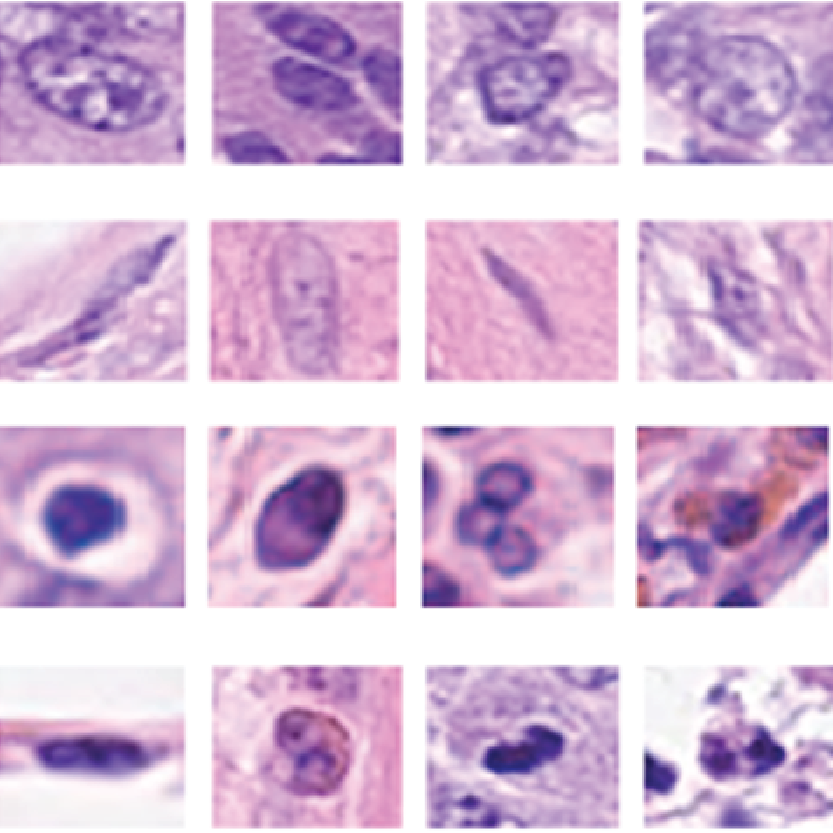 Nuclei Classification