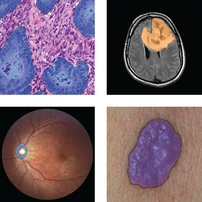 Tissue Segmentation